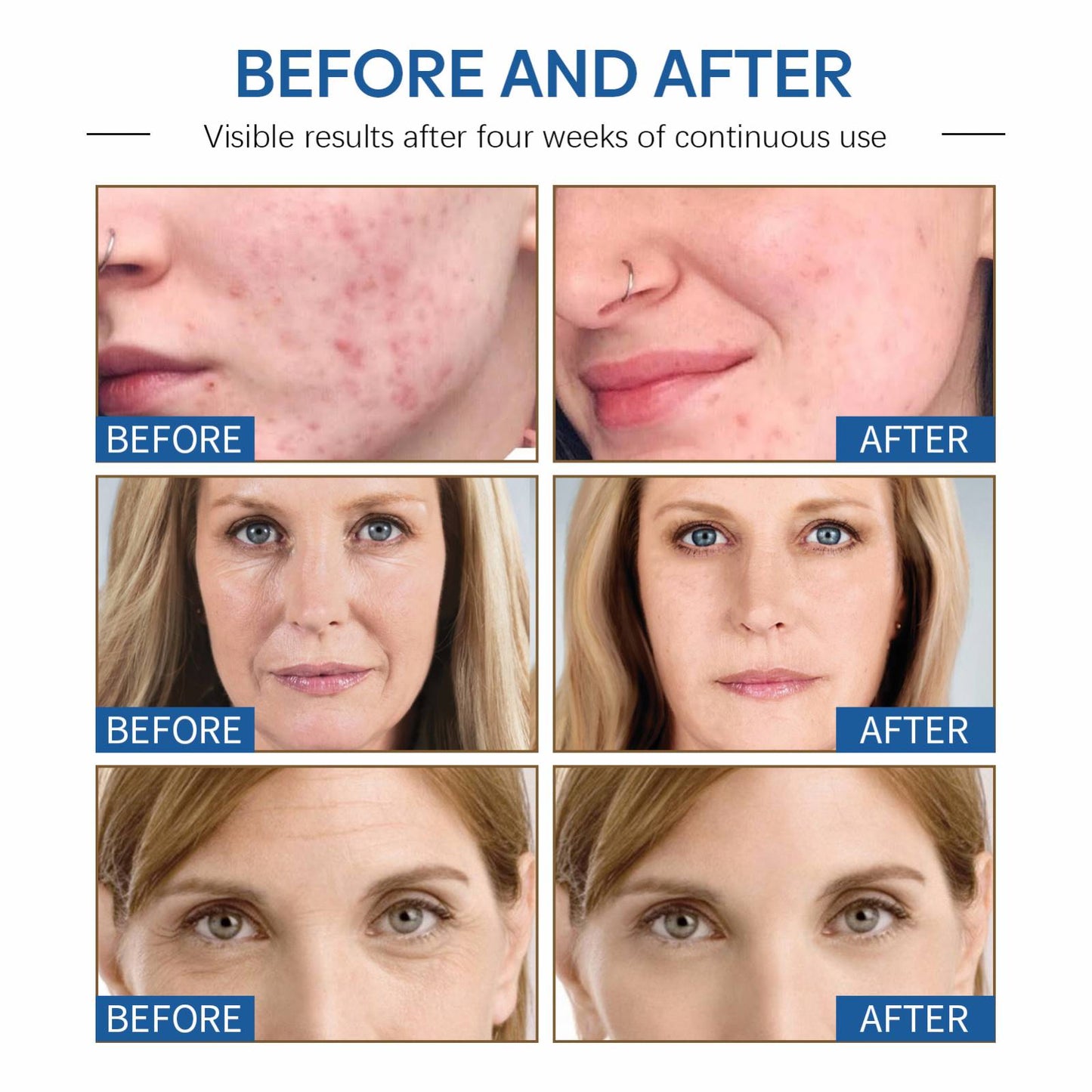 OUHOE Magic Cream (All‑Purpose Skin Cream)