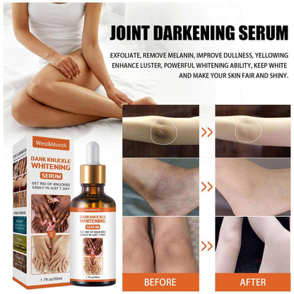 Skin Care Serum Vitamin C Brightening Whitening Skin Lifting Skin Care Serum Niainamide for Anti Aging Vitamin c Serum knucles, elbow, knees