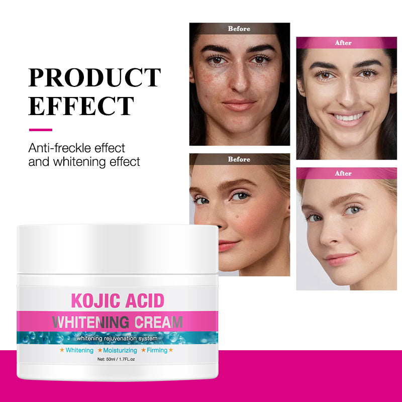 Kojic Acid Whitening Cream
