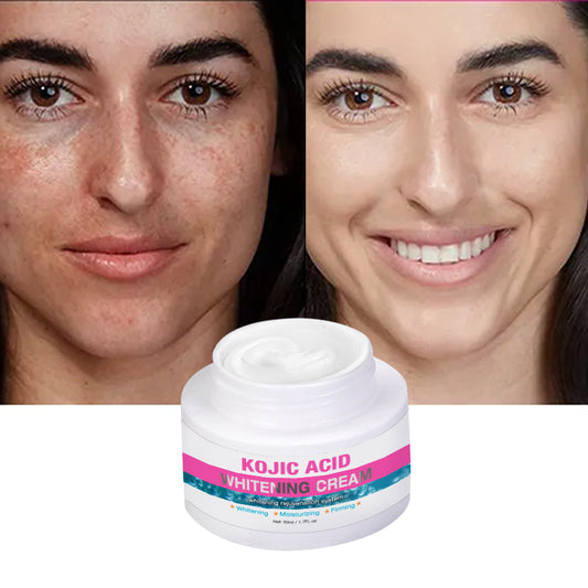 Kojic Acid Whitening Cream