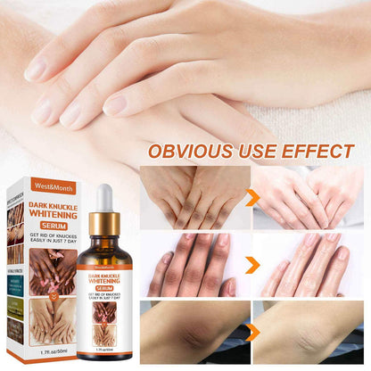 Skin Care Serum Vitamin C Brightening Whitening Skin Lifting Skin Care Serum Niainamide for Anti Aging Vitamin c Serum knucles, elbow, knees