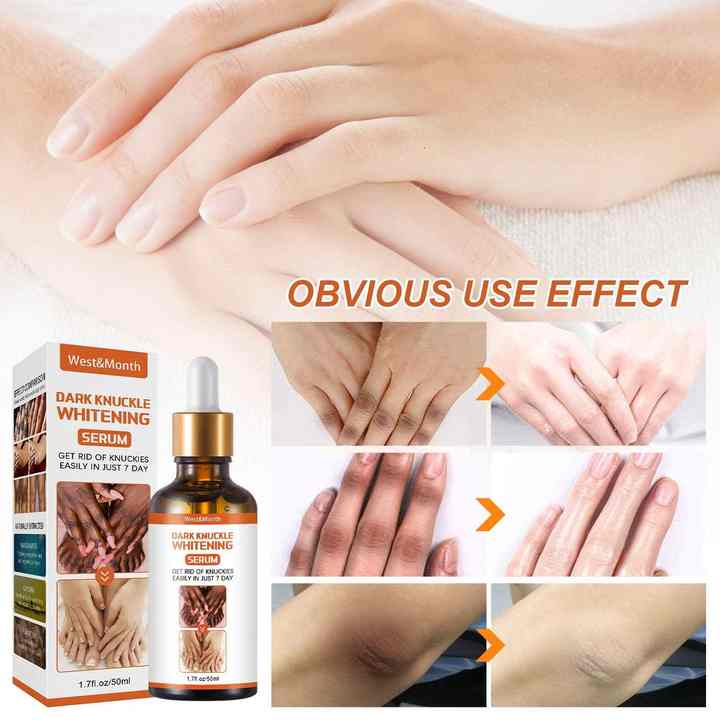 Skin Care Serum Vitamin C Brightening Whitening Skin Lifting Skin Care Serum Niainamide for Anti Aging Vitamin c Serum knucles, elbow, knees