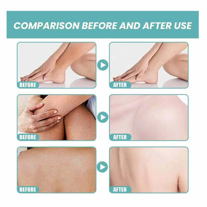 Roushun Glutathione C + Niacinamide Body Treatment Cream