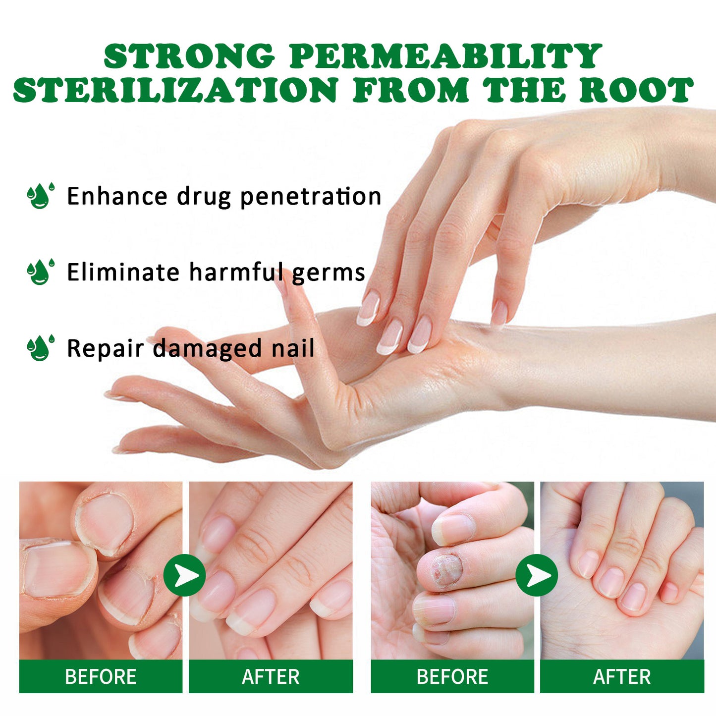 Jaysuing 7 Days Nail Fungus Treatment
