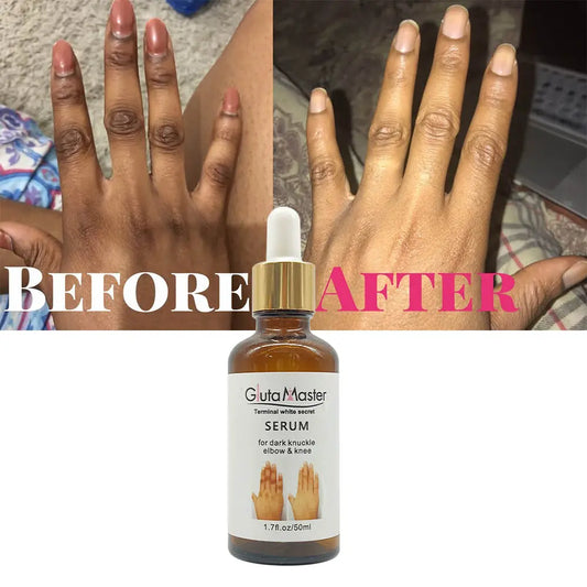 Gluta Master Serum for Dark Knuckles, Knees, and Elbows