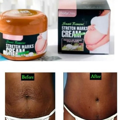 Danjia Snail Remove Stretch Marks Cream