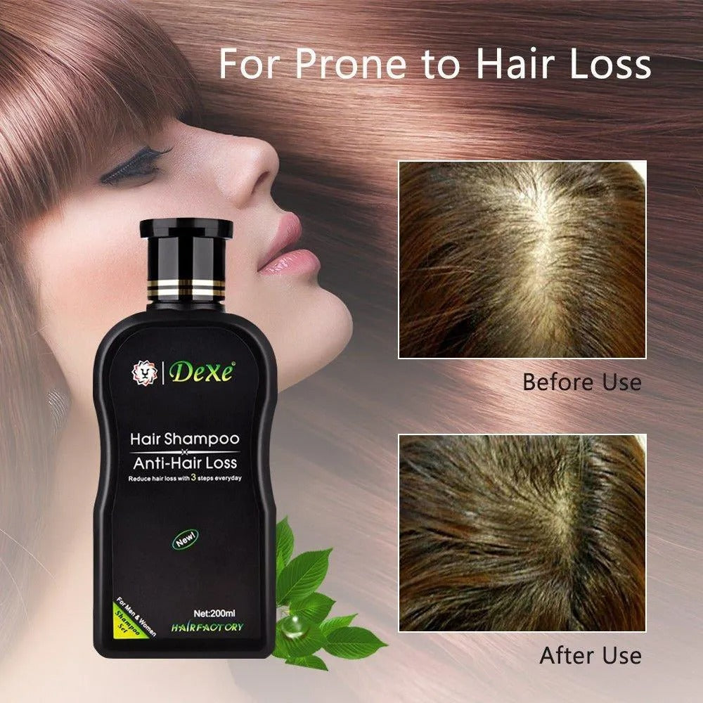 Dexe Anti-Hair Loss Shampoo – 200ml for men & women