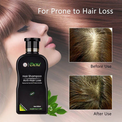 Dexe Anti-Hair Loss Shampoo – 200ml for men & women