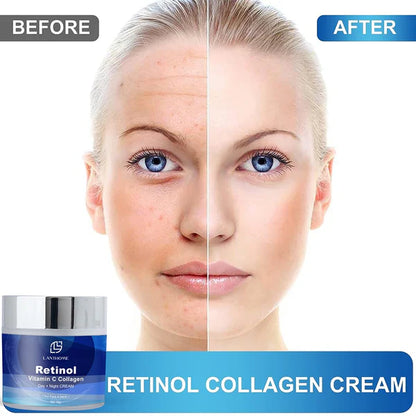 Lanthome Retinol Facial Cream