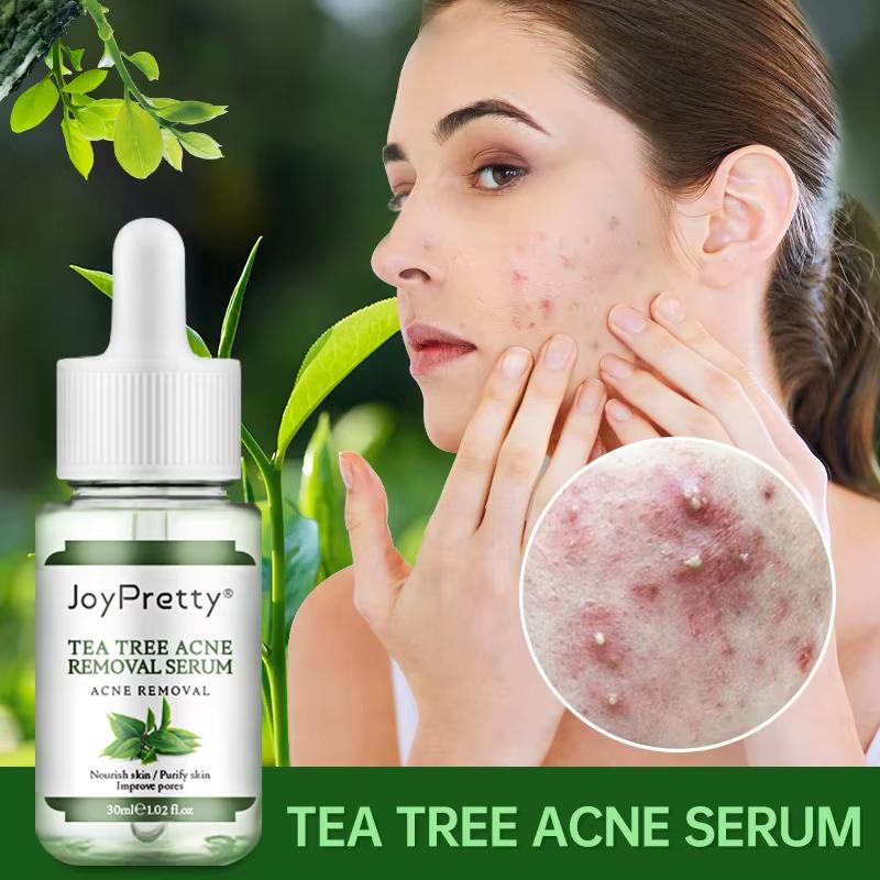 JoyPretty Tea Tree Acne Removal/ Treatment Serum (30 ml)