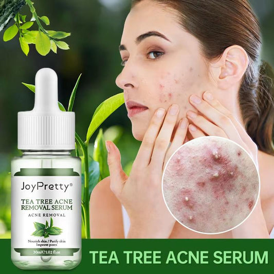 JoyPretty Tea Tree Acne Removal/ Treatment Serum (30 ml)