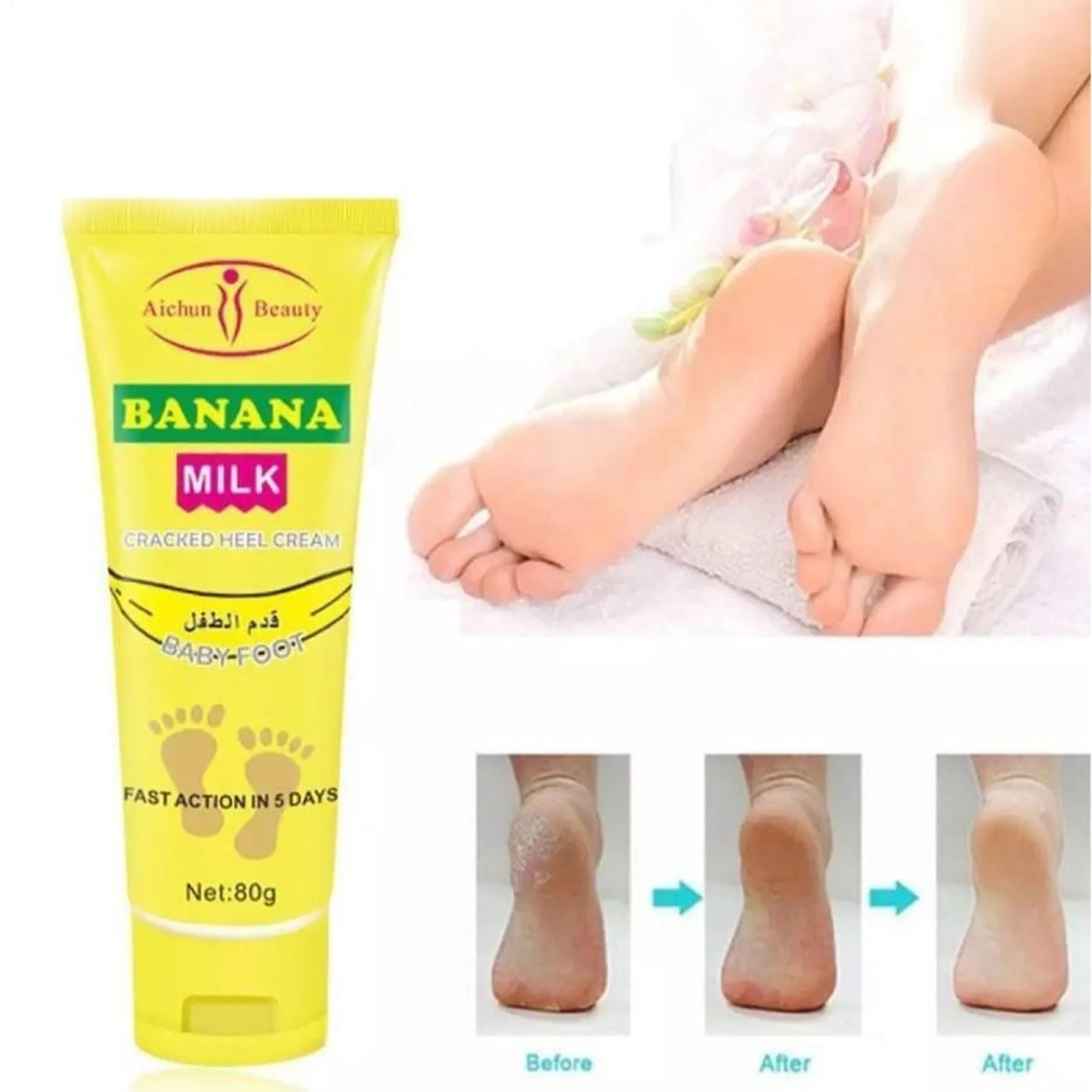 Aichun Beauty Cracked Heel Cream Foot Care Banana Milk Cream - 80g