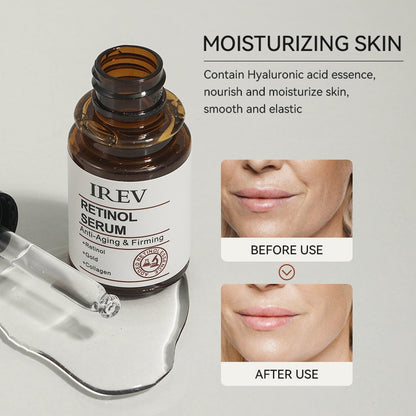 IREV Retinol Serum (30ml)