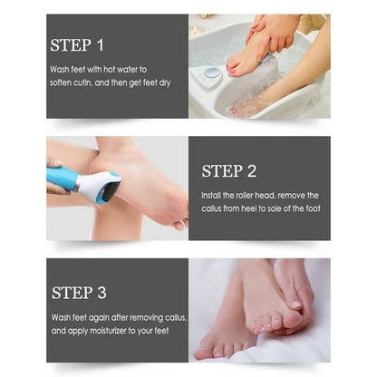 Electric Foot Grinder – Battery Powered with Roller Head