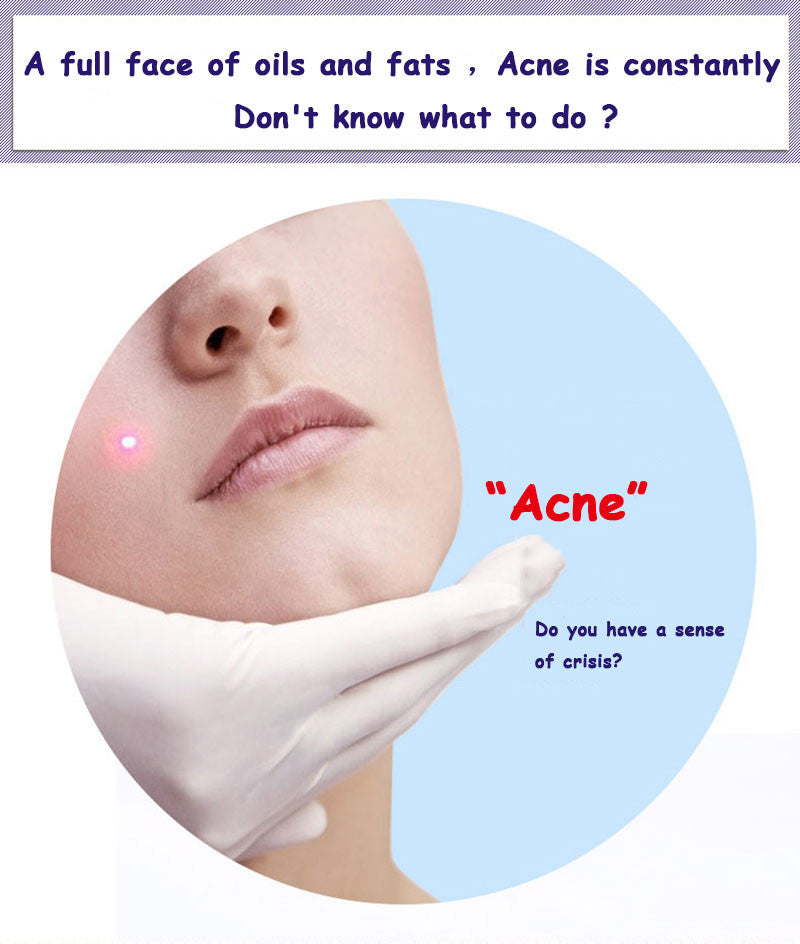 BIOAQUA Acne Removal & Acne Serum Solution
