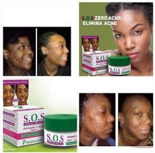 Pharmaderm SOS Zero Acne Facial Antiseptic Cream