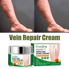 Guanjing Varicose Vein Cream Spider Varicose Vein Cream Improves Blood