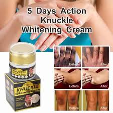 O'Carly Knuckle Whitening Cream. Clears Dark Knuckles Spots