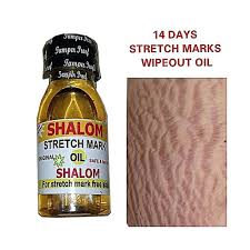 Shalom stretch mark oil