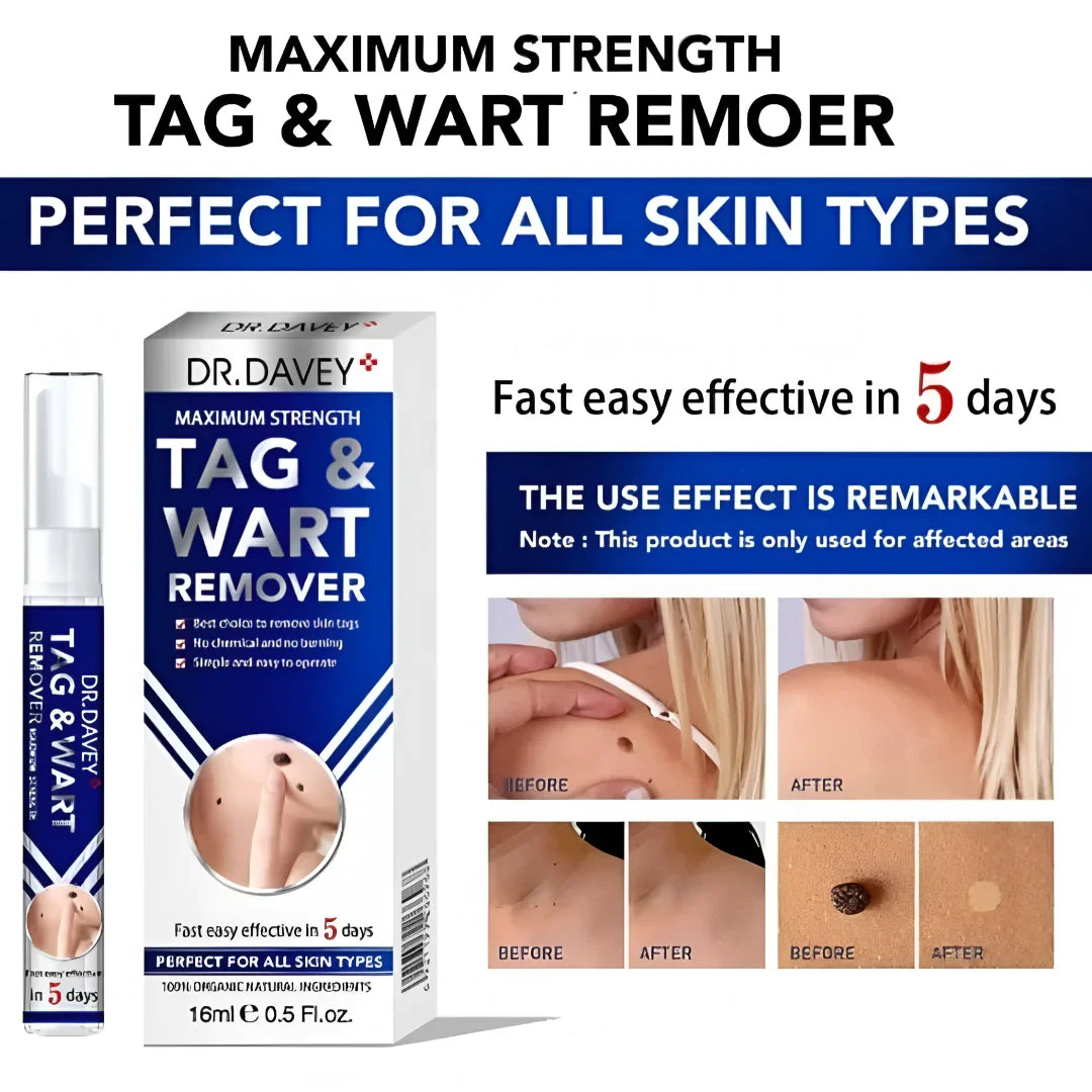 Dr. Davey Maximum Strength Tag & Wart Remover