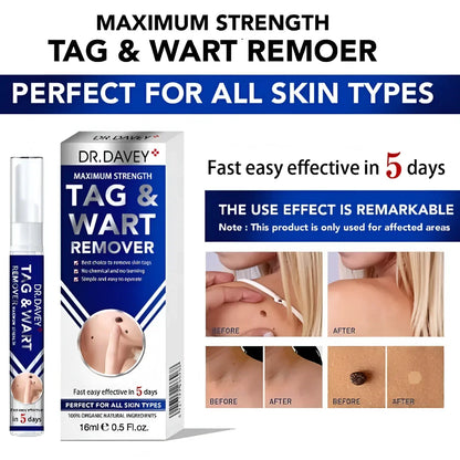 Dr. Davey Maximum Strength Tag & Wart Remover