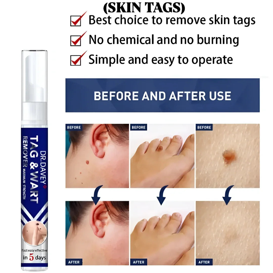 Dr. Davey Maximum Strength Tag & Wart Remover