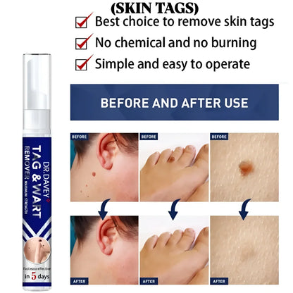 Dr. Davey Maximum Strength Tag & Wart Remover