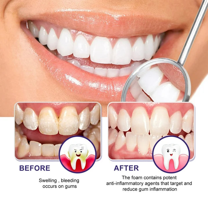 West & Month Gum Smoothing Foam