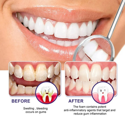 West & Month Gum Smoothing Foam