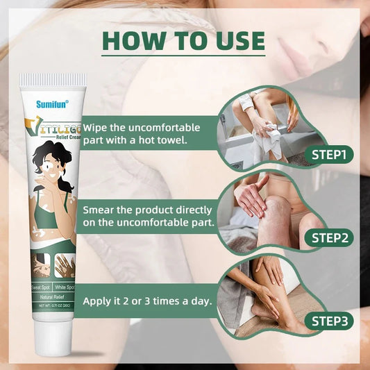 Sumifun Vitiligo Relief Cream