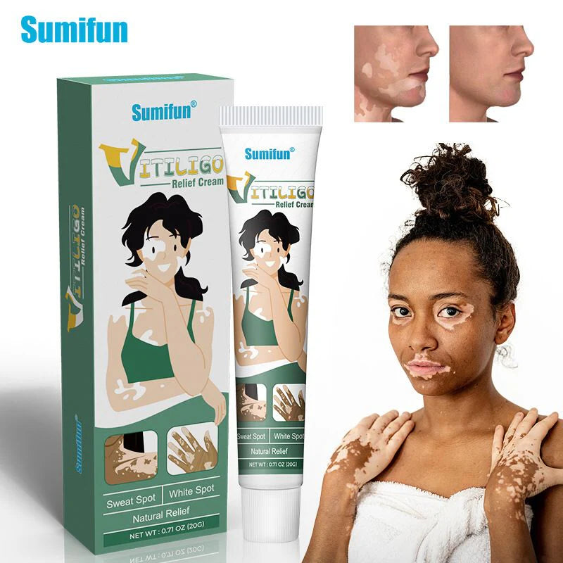 Sumifun Vitiligo Relief Cream