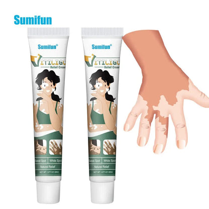 Sumifun Vitiligo Relief Cream