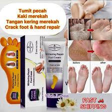 Aichun Beauty Whitening Foot Repair Cream For Dry. Cracked And Rough Feet