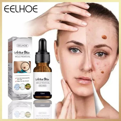 Eelhoe Active Skin Mole Reduce Serum Spot-10ml