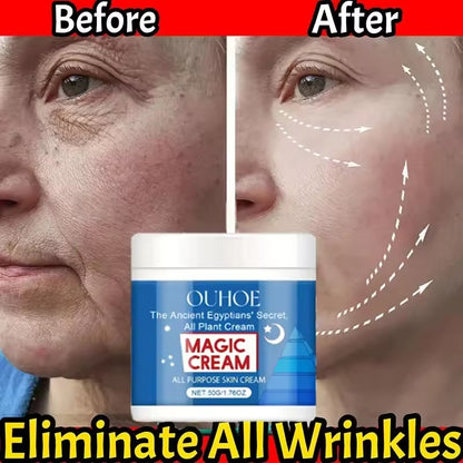 OUHOE Magic Cream (All‑Purpose Skin Cream)