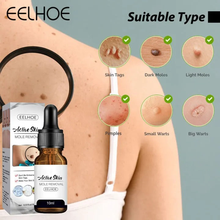 Eelhoe Active Skin Mole Reduce Serum Spot-10ml