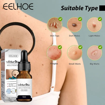 Eelhoe Active Skin Mole Reduce Serum Spot-10ml