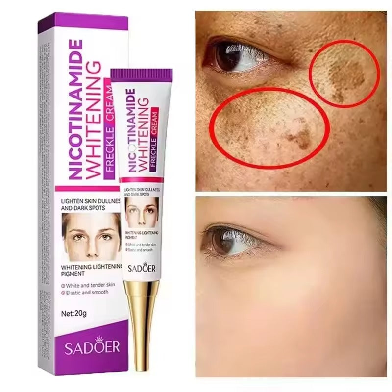 SADOER Nicotinamide Removing Freckle Cream (20 g)