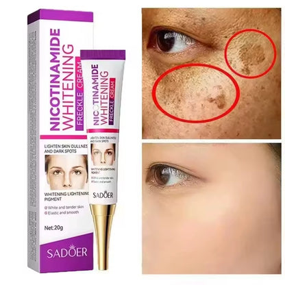 SADOER Nicotinamide Removing Freckle Cream (20 g)