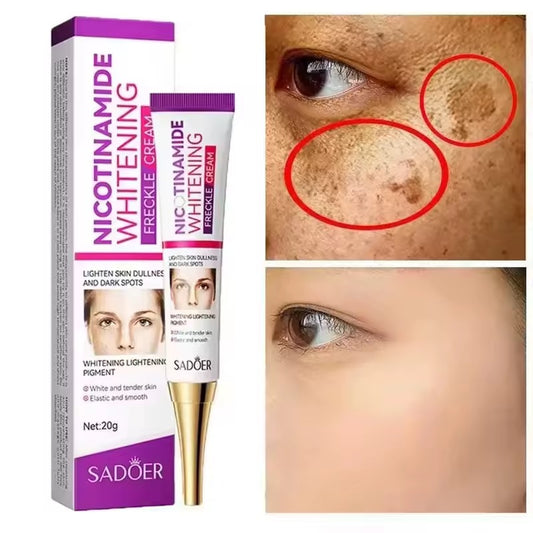 SADOER Nicotinamide Removing Freckle Cream (20 g)
