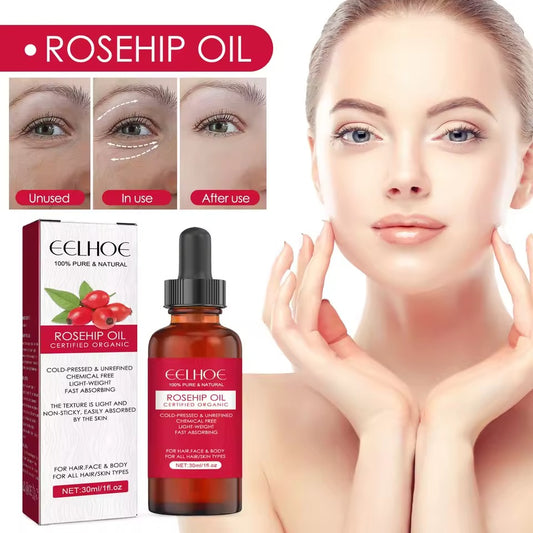 EELHOE Rosehip Facial Essential Oil