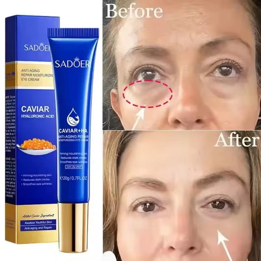 SADOER Caviar + HA Anti‑Aging Repair Moisturizing Eye Cream