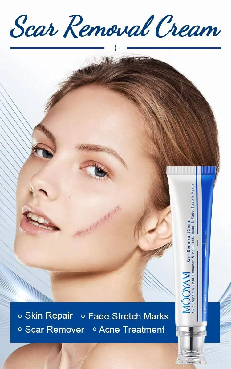🔥 FLASH SALE — MOOYAM Acne Scar Removal Cream | Fade Dark Spots + Even Skin Tone | KSh 1,800 (