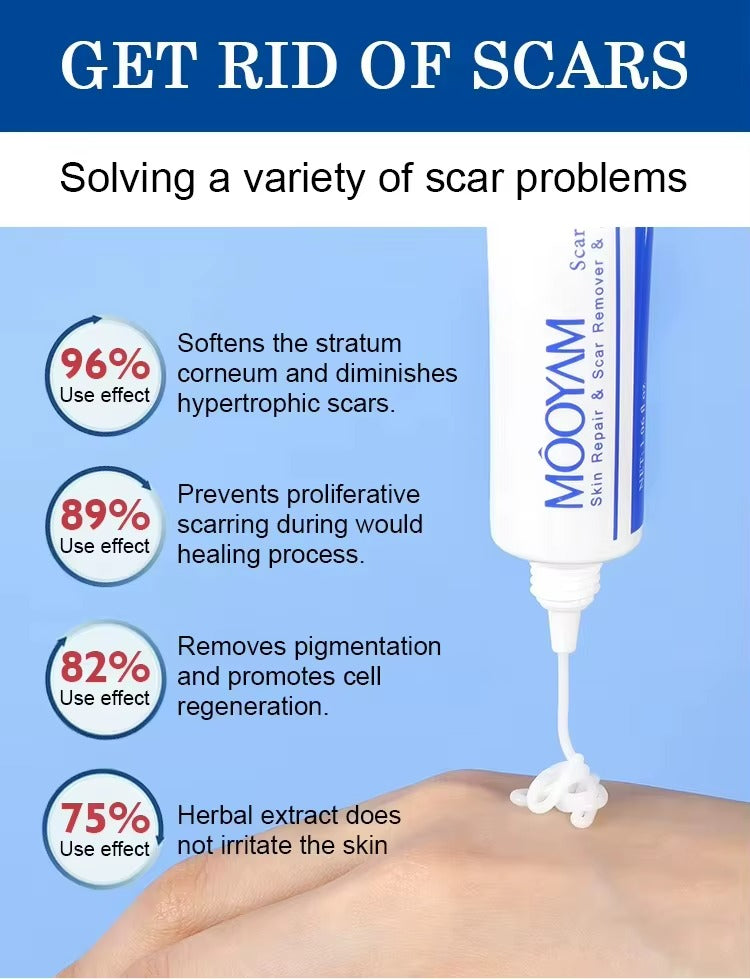 🔥 FLASH SALE — MOOYAM Acne Scar Removal Cream | Fade Dark Spots + Even Skin Tone | KSh 1,800 (