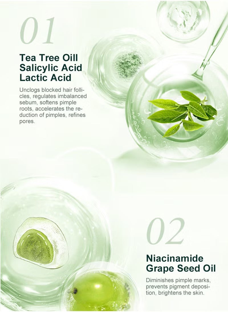 JoyPretty Acne Control Cream with Tea Tree Oil & Vitamin B3 (Niacinamide)