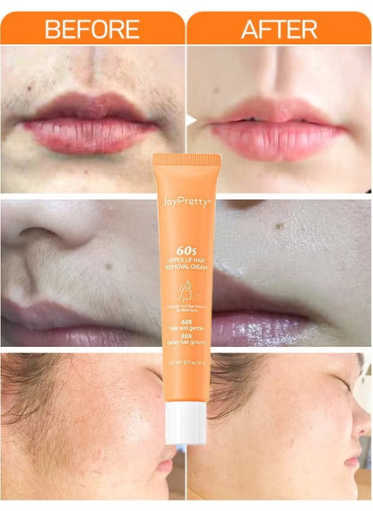 JoyPretty 60 Seconds Upper Lip Hair Removal Cream (20 g)