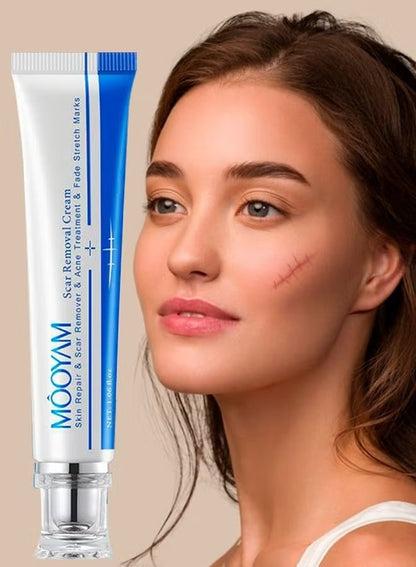 🔥 FLASH SALE — MOOYAM Acne Scar Removal Cream | Fade Dark Spots + Even Skin Tone | KSh 1,800 (