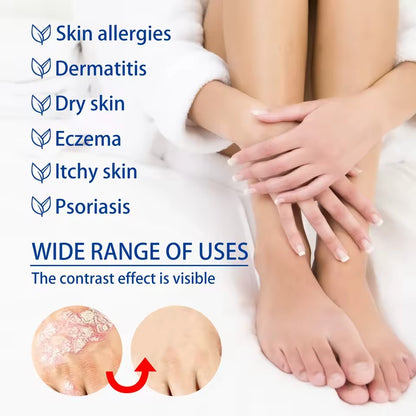 Psoriasis Repair Herbal Ointment