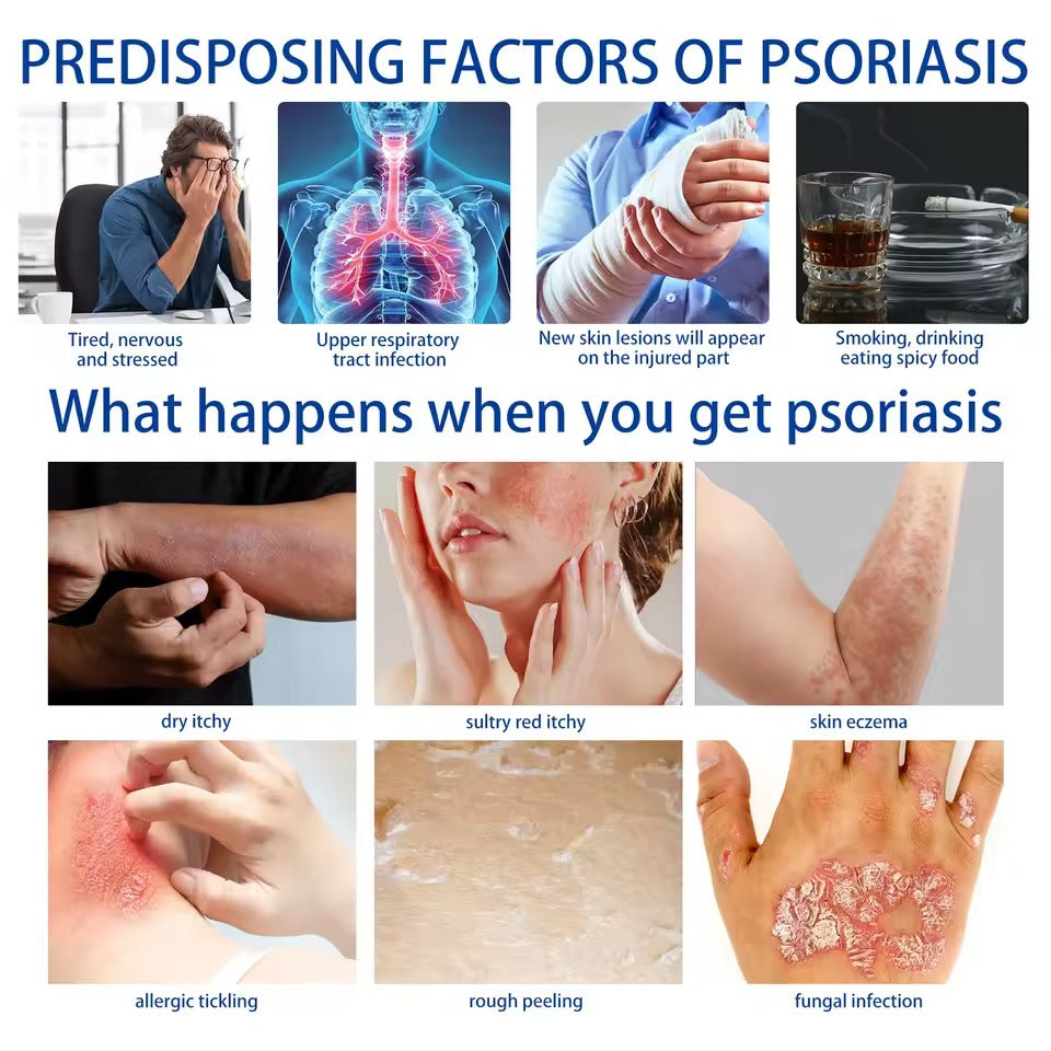 Psoriasis Repair Herbal Ointment