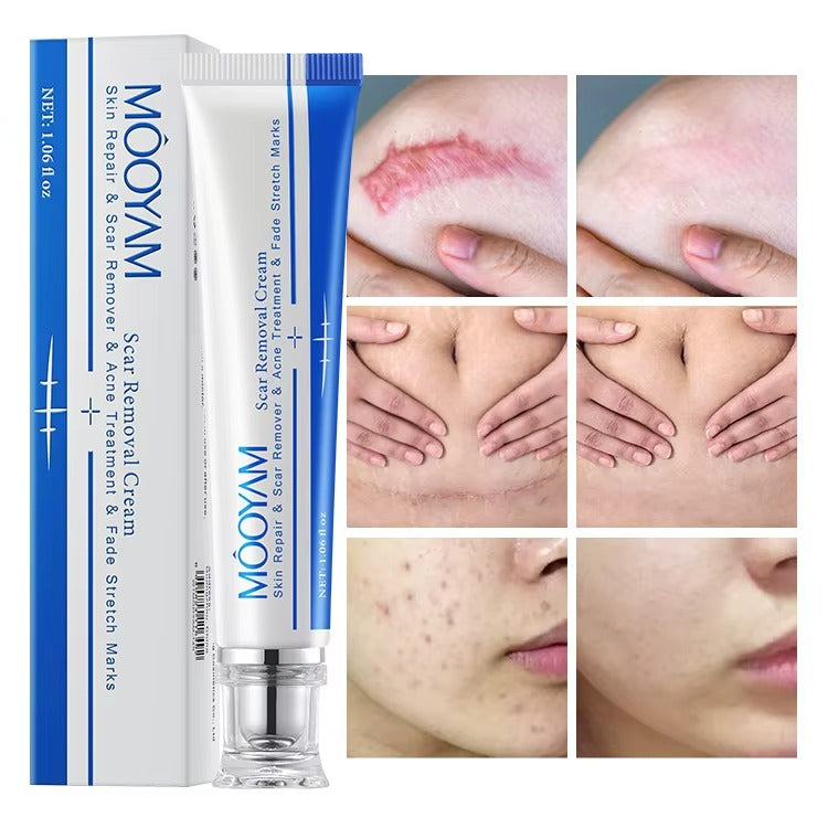 🔥 FLASH SALE — MOOYAM Acne Scar Removal Cream | Fade Dark Spots + Even Skin Tone | KSh 1,800 (